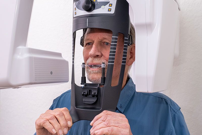 cbct scan for blue shirt man